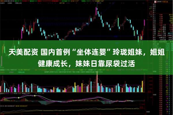 天美配资 国内首例“坐体连婴”玲珑姐妹，姐姐健康成长，妹妹日靠尿袋过活